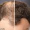 Toppik Hair Building Fibers - Grå 12g - Hairsale.se